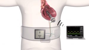 Fineheart annonce une levée de fonds de 15 millions d’euros